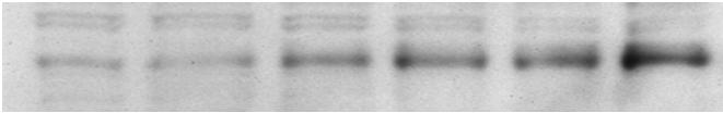 hepatoma cells - Hepa 1c1c7 Nrf2 translocation 1 hour Relative Nuclear Nrf2