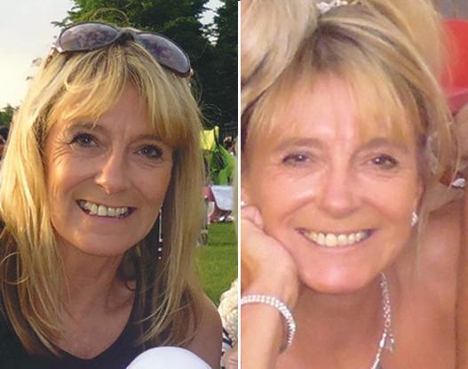 Hazel 'Before and after Rejuvenated Collagen Shots.