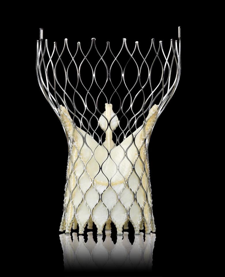 CoreValve Bioprosthesis Outflow Orientation Maximizes Flow Constrained Portion Valve Function Supra-annular leaflet function Designed to avoid