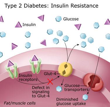 Diabetes Insulin resistance Decreased glucose uptake