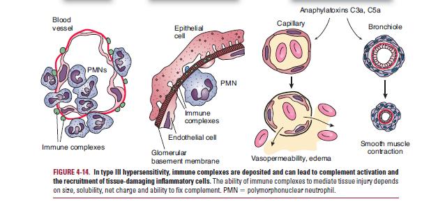 3-type III hypersensitivity reactions, the antibody responsible for tissue injury is also usually IgM or IgG, but the mechanism of tissue injury differs.