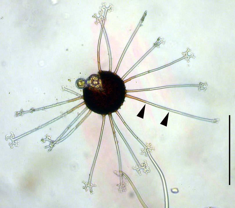 Fig. 4 Mature, slightly squashed ascoma of Erysiphe platani in the light microscope. Note the brown bases of appendages and presence of septa (arrowheads). Scale Bar = 200 µm.