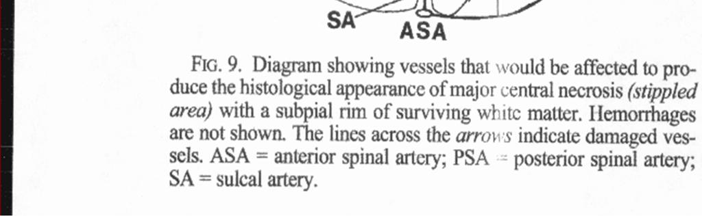 Lumbar cord Penetrating branches from ASA dive into ventral sulcus NO