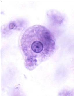 infection Cell