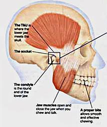 Muscles of Mastication Masseter muscle It is a quadrilateral muscle which covers lateral surface of the Ramus of the mandible.