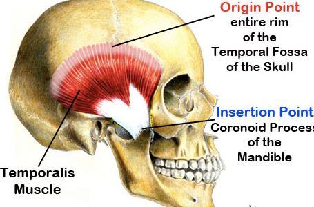 Temporalis muscle Origin:Arises from temporal fossa and from temporal fascia.