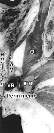 U-shaped contour of posterior vaginal wall in level III and W-shaped contour in level II are shown. B Fig 2.