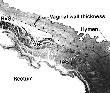 The term endopelvic fascia is used to denote those tissues between the vaginal muscularis and adjacent organs or the pelvic walls.
