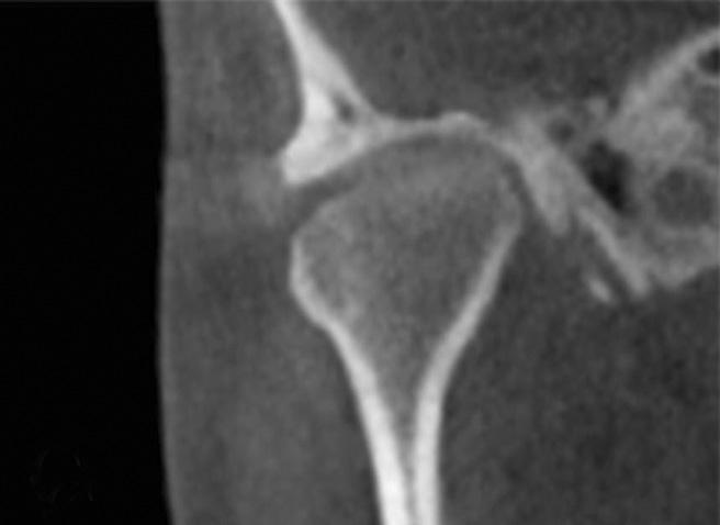 sagittal (H), and coronal (I) in superimposed images.