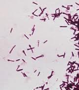 Clostridium tetani Widely distributed in the environment and in