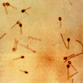 culture) β-haemolysis when grown on blood agar grow well in