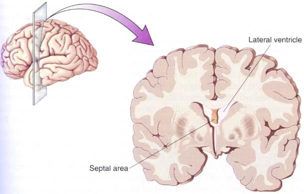 Brain Stimulation in Humans Patient A Septal area alert, good feeling self-stimulation Hippocampus mild pleasure Tegmentum alert, unpleasure Patient B Septal area, tegmentum pleasure