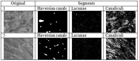 2 Cortical bone image captured at 5X magnification, showing grids of small images (captured at 20X magnification). Fig. 3 Resultant segments of some of the images shown in Fig. 2 IV.