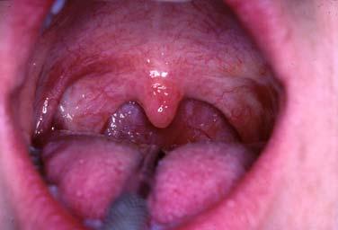 Aim To provide an overview of some key problems in oral mucosal pathology Outline To review oral potentially malignant lesions To review