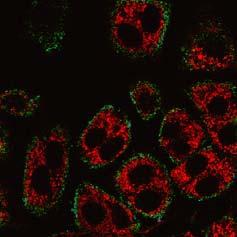 A: Fluorescent images of PC12 cells stained with ER9Q protein (green, plasma membranes) and mitochondria-specific dye TMRM (red).