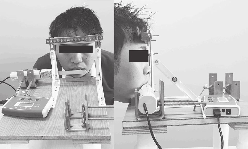 Tongue Protrusion Strength in Obstructive Sleep Apnea 243 Fig. 1. Measurement of tongue protrusion strength. Jaw and forehead in each subject were fixed to prevent the change of posture.