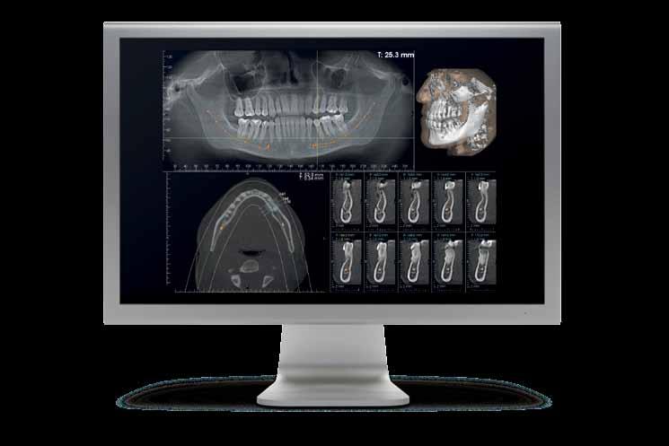 Radiology center Airway diagnostics 11cm APPLICATIONS Captures entire adult dentition
