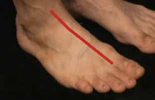 Pulses The foot contains two pulses in arteries bringing blood into the area. Tibialis Posterior: To palpate pulse, place fingers behind and slightly below the medial malleolus of the ankle.