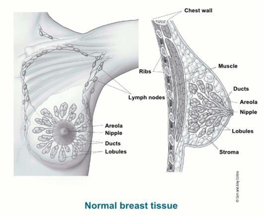 II. METHODS Detection of tumors in mammogram is divided into three main stages.