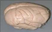 Human brain continues to develop after birth The rate of growth after birth is higher humans