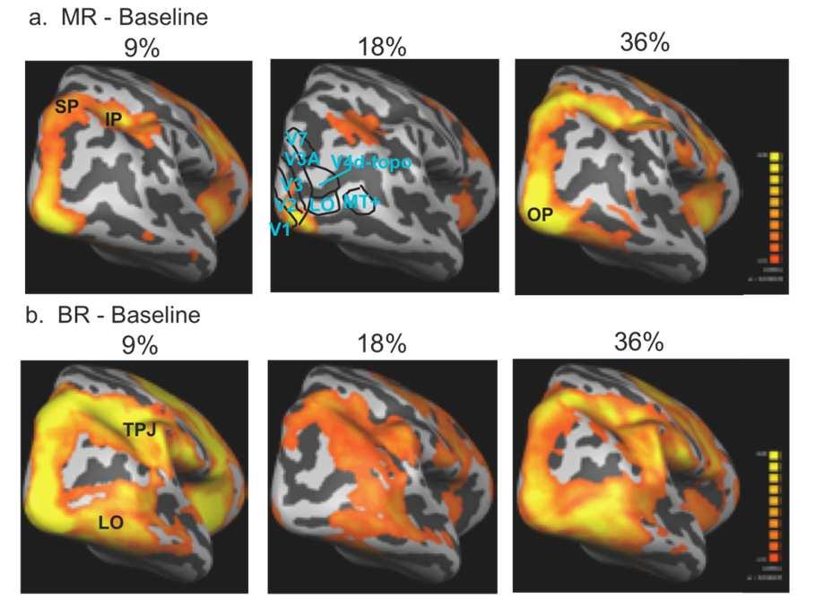 88 Visual Cortex Current Status and Perspectives A dissociation between dorsal and ventral areas in human fmri studies relates to greater selectivity for object recognition using shape defined by