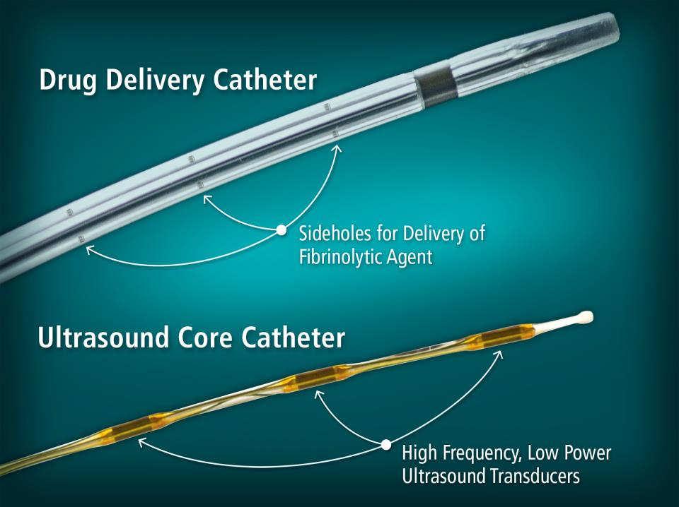 patient required surgery to stop the bleeding 7 patients had bleeding >3 units Catheter Techniques: