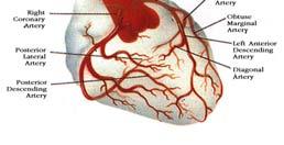 pain results from ischemia. Ischemic heart disease involves decreased blood flow to the heart.