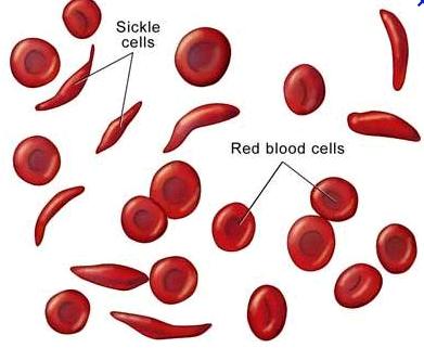 III. Types of Formed Elements Red Blood Cells: (Erythrocytes) > Contains protein hemoglobin transports O 2 & CO 2 > Erythropoietin / EPO (hormone) controls RBC production throughout lifetime Kidneys