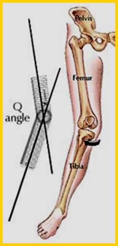 Increased Q-angle -Female hip to knee