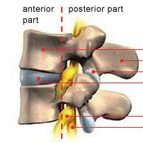 Location of vertebral tumors Vertebral body Spinous process Vertebral joint Intervertebral disc Spinal nerve Spinal cord Benign bone tumors, such as