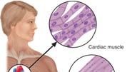 cardiac Skeletal muscle attaches to the bones