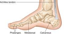 Foot bones (metatarsals) Toe