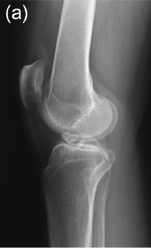 2 Case Reports in Orthopedics (c) Figure 1: Plain radiography of our patient.