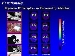 massive dopamine release by decreasing dopamine