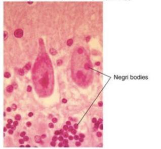 Inclusion Bodies Caused by Rabies Virus: - A lyssavirus (extra info: is a genus of RNA viruses