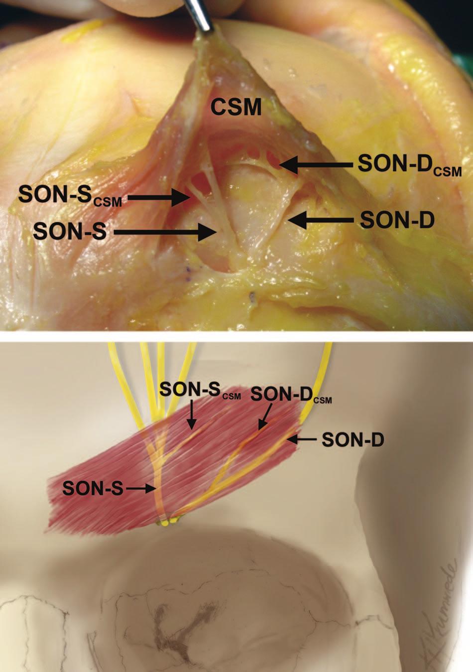 (Below) SON-D branching was simplified for illustration purposes.