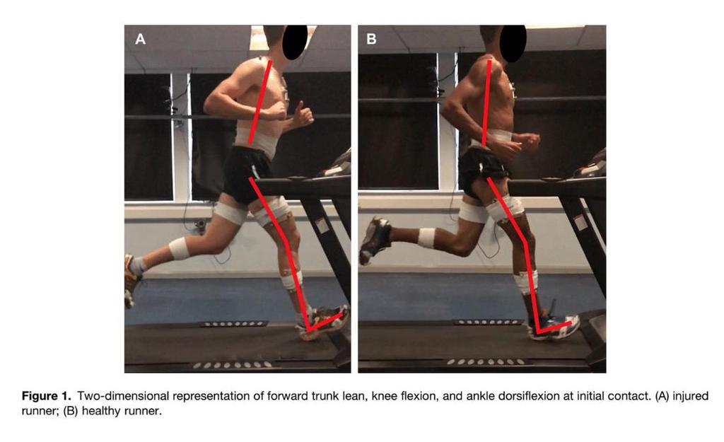 Running Analysis Is There a Pathological Gait Associated