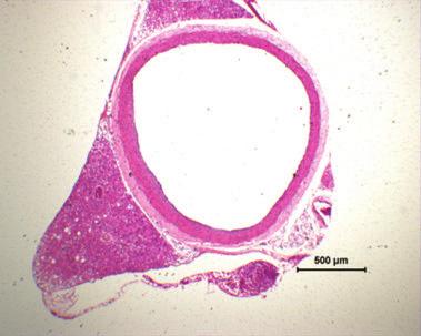 Vascular tissues were stained with hematoxylin-eosin for morphometric analysis.