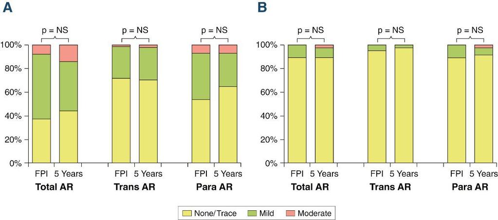 TAVR SAVR (A) Trend in AV area, AV area index, and Doppler velocity index (DVI) from first post-implant (FPI) through 5 years in TAVR patients with paired echocardiograms.