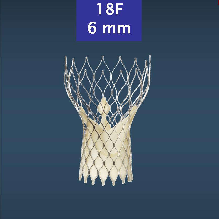 CoreValve Evolution: Past to Present Gen 3 18F 6 mm 2007-2010 16,000 implants to date