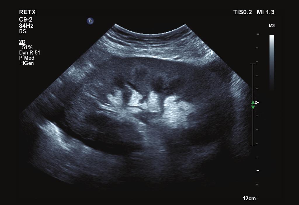 An initial scan from the reference system produced insufficient image quality to provide information beyond the location of the kidney and a lack of hydronephrosis. Doppler assessment was also poor.