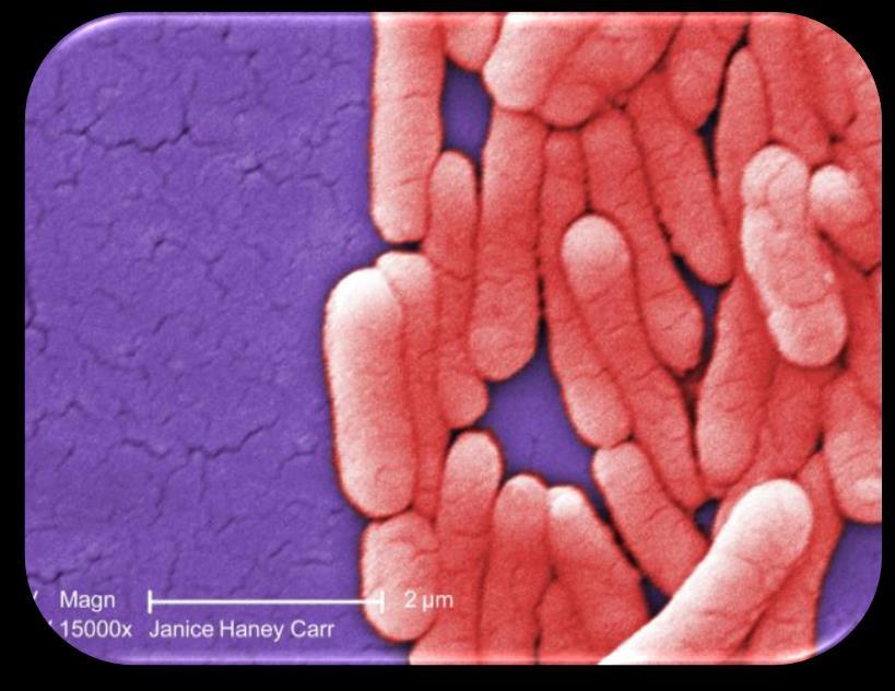 About Foodborne Illness: Salmonella Foodborne Illness in Older Adults Campylobacter E.