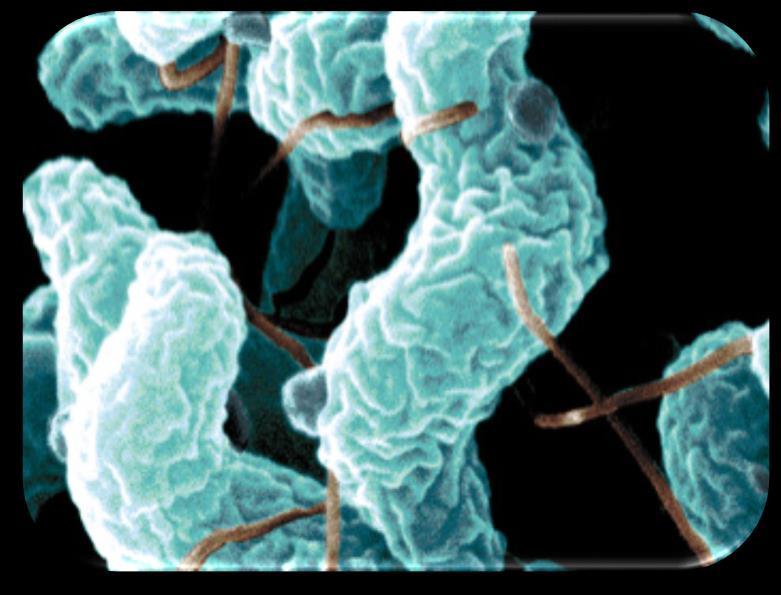 About Foodborne Illness: Campylobacter Foodborne Illness in Older Adults Campylobacter E.