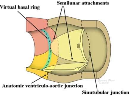 Aortic Root Anatomy Anatomic segment between LV and Asc Ao 1.