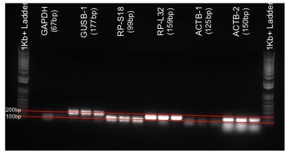 These primer-probe sets appear to be specifically amplifying the desired gene product based on amplification of RNA isolated from kidney tissue. Fig. 1.