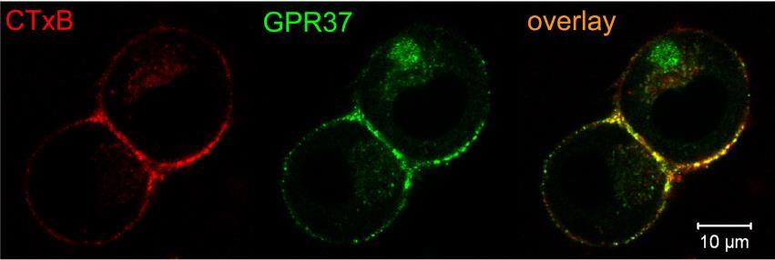 GPR-37 (juvenile Parkinson s disease) Changes in raft lipid content can prevent apoptosis induced by death