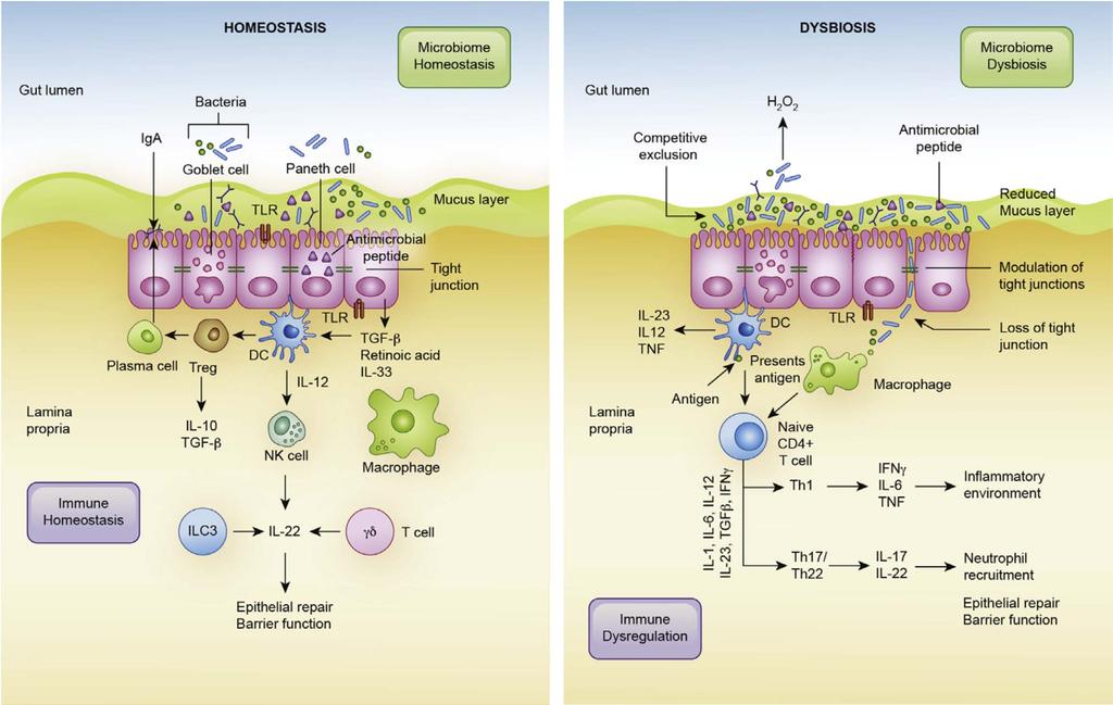 Microbiome is linked to general inflammation Costello