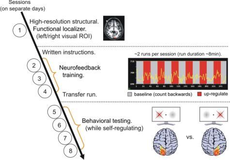 brain activity predict whether or not a stimulus will be perceived. (Fox & Raichle, 2007; Hesselmann et al.