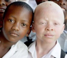 How do genes influence our characteristics? To begin, we will review and extend an analysis of the genetics of albinism.