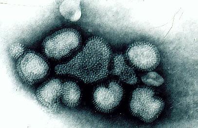 Influenza virus Type A, B, C segmented genome ss RNA